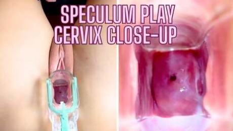 Stella St. Rose - Speculum Play, See My Cervix Close Up